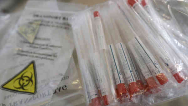 Peste 6.000 de persoane testate pozitiv pentru o altă boală infecțioasă. Tot din China provine Peste 6.000 de persoane testate pozitiv pentru o altă boală infecțioasă. Tot din China provine