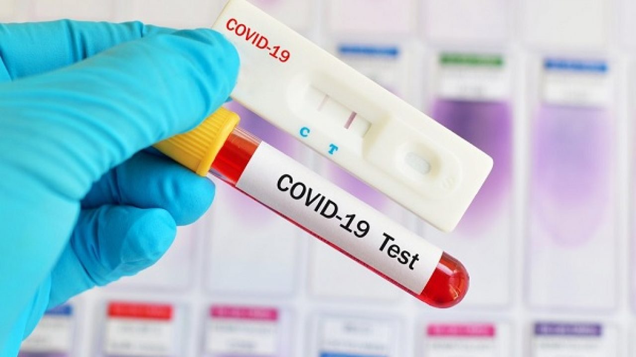 Angajații, obligați să se testeze pentru COVID-19?! Ce poate solicita angajatorul și cine suportă cheltuielile? Angajații, obligați să se testeze pentru COVID-19?! Ce poate solicita angajatorul și cine suportă cheltuielile?