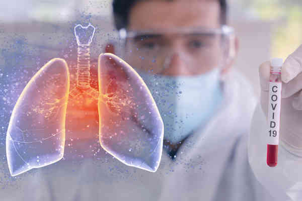 CoVid-19 BN: 82 infectați, 2 decedați! Situația în țară CoVid-19 BN: 82 infectați, 2 decedați! Situația în țară